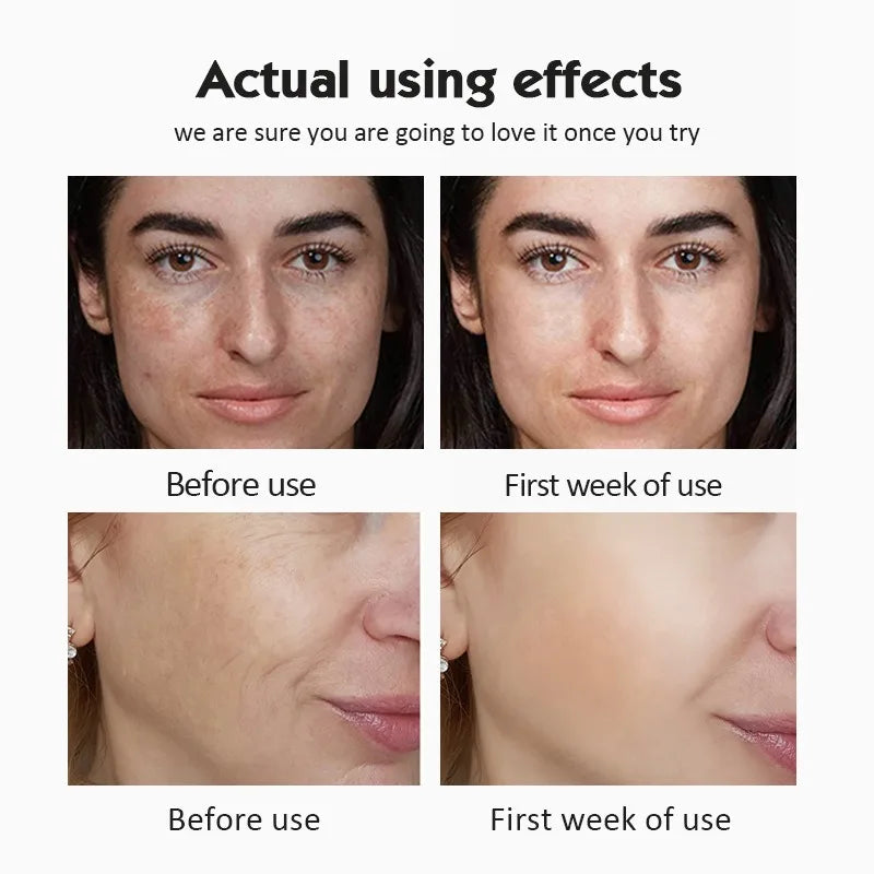 20% Vitamin C Ampoule Serum Set Moisturising Whitening Wrinkle Reducing Anti-Ageing Serum Face Beauty Skin Care