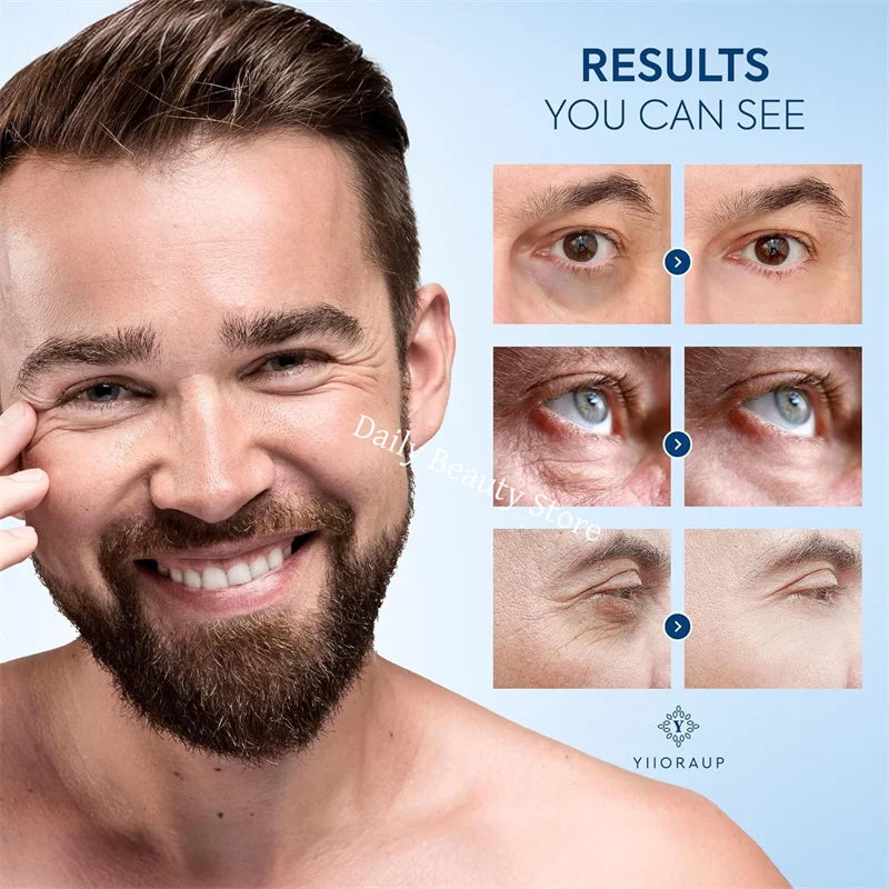 Instant Eye Bag Remove Eye Cream Anti Fat Particles Dark Circles Puffiness Fade Fine Lines Lift Brighten Korean Beauty Eye Care