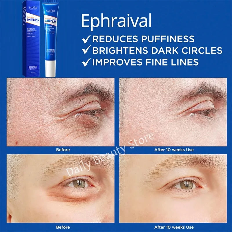 Instant Eye Bag Remove Eye Cream Anti Fat Particles Dark Circles Puffiness Fade Fine Lines Lift Brighten Korean Beauty Eye Care