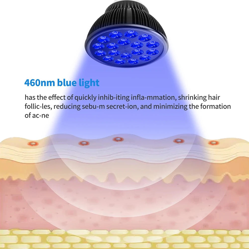 18 LEDs Blue Light Tanning Therapy Lamp 460nm for Face and Body Skin Care Acne Spots Removal Physiotherapy Device Beauty Lamp